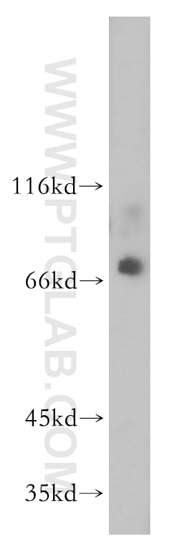 Western Blot (WB) analysis of HEK-293 cells using ZFP64 Polyclonal antibody (17187-1-AP)
