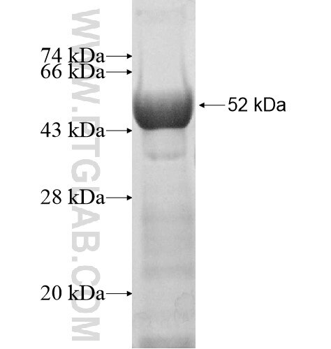 ZFP64 fusion protein Ag11251 SDS-PAGE