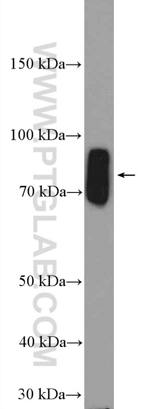 Western Blot (WB) analysis of rat testis tissue using ZFP90 Polyclonal antibody (26120-1-AP)