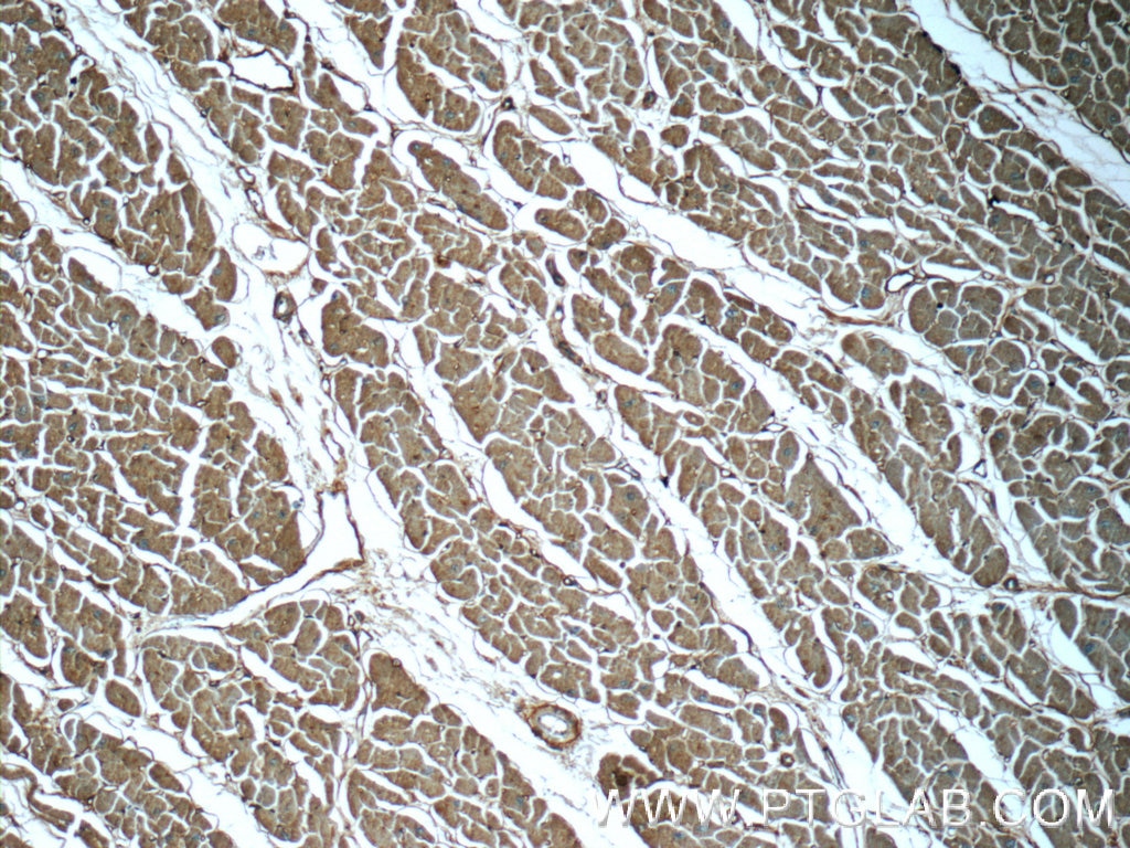 Immunohistochemistry (IHC) staining of human heart tissue using ZFR Polyclonal antibody (23174-1-AP)