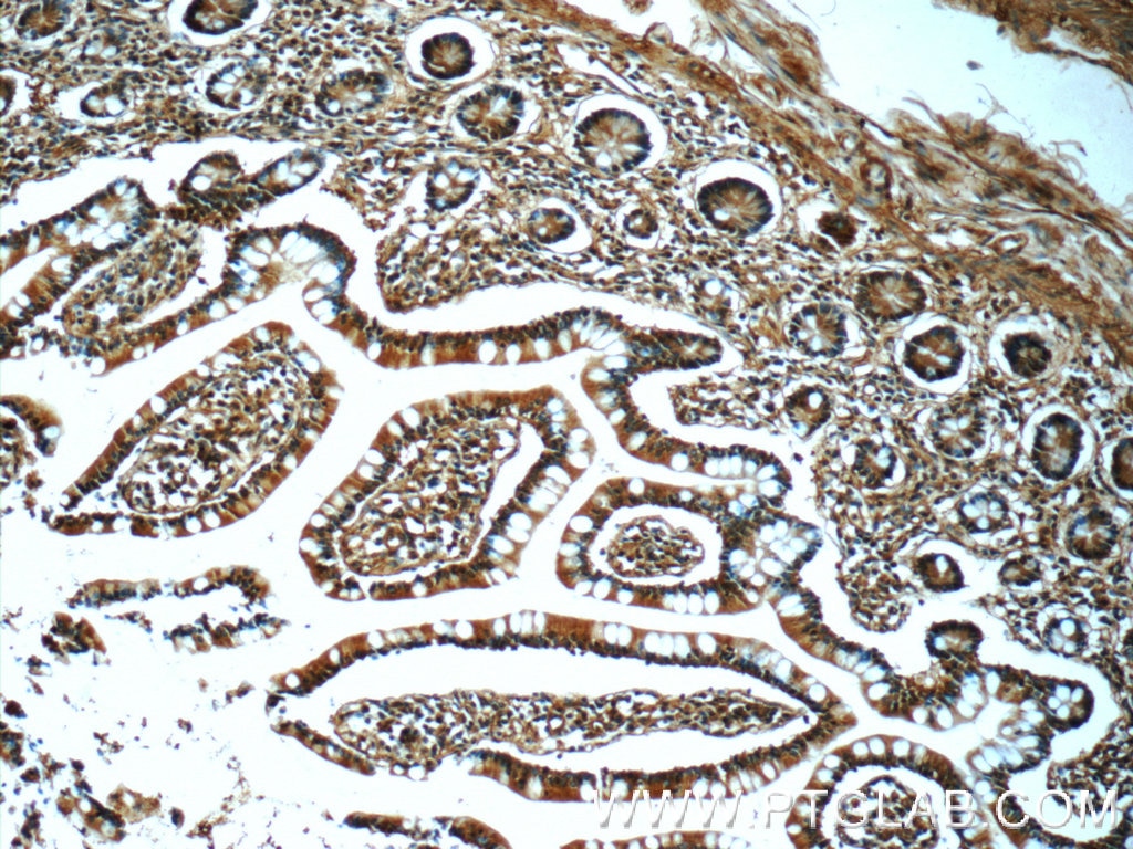 Immunohistochemistry (IHC) staining of human small intestine tissue using ZFR Polyclonal antibody (23174-1-AP)