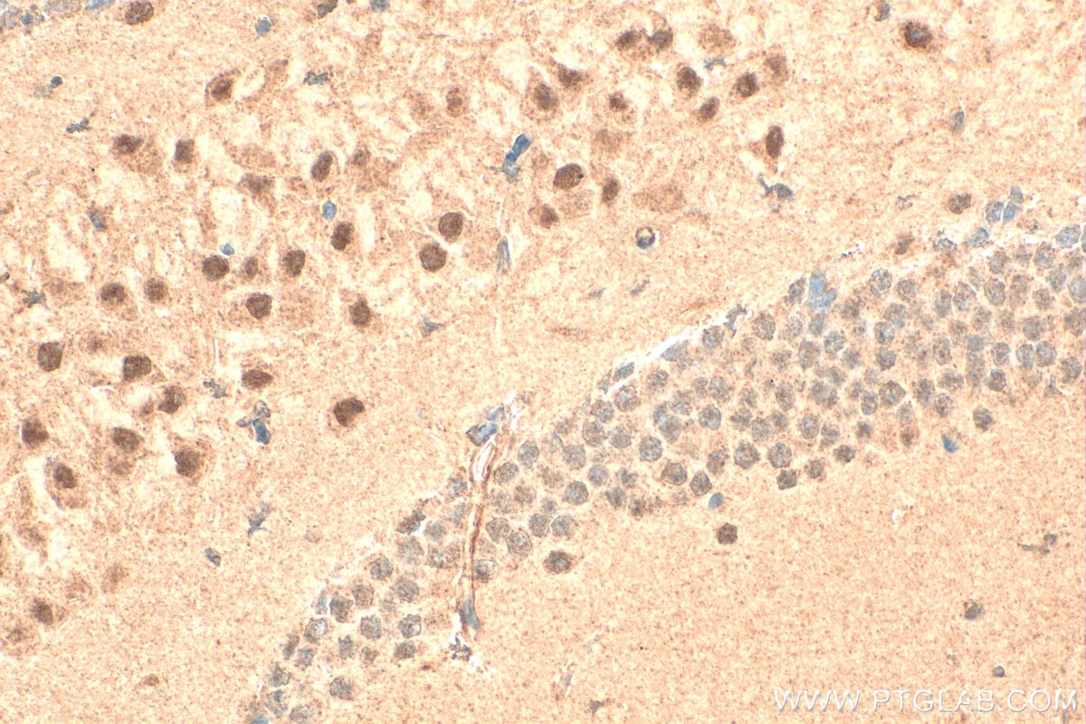 Immunohistochemistry (IHC) staining of mouse brain tissue using ZFR Polyclonal antibody (23174-1-AP)