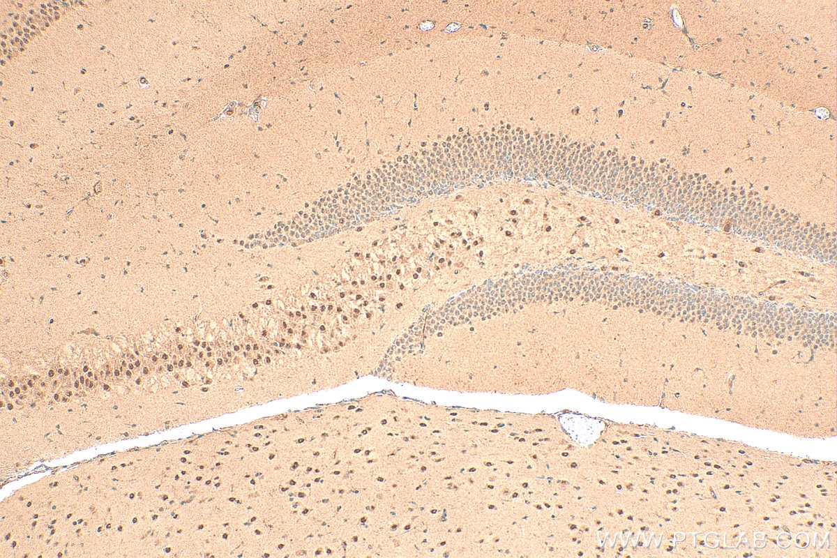 Immunohistochemistry (IHC) staining of mouse brain tissue using ZFR Polyclonal antibody (23174-1-AP)