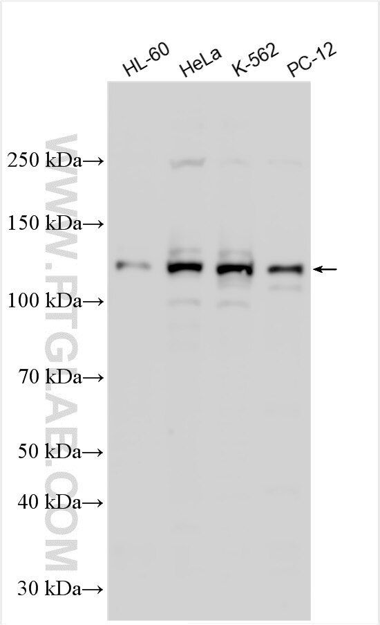 Western Blot (WB) analysis of various lysates using ZFX Polyclonal antibody (27655-1-AP)