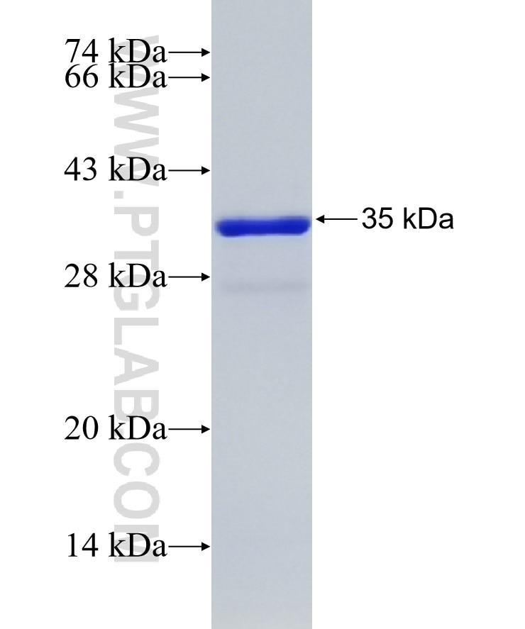 ZFX fusion protein Ag26576 SDS-PAGE