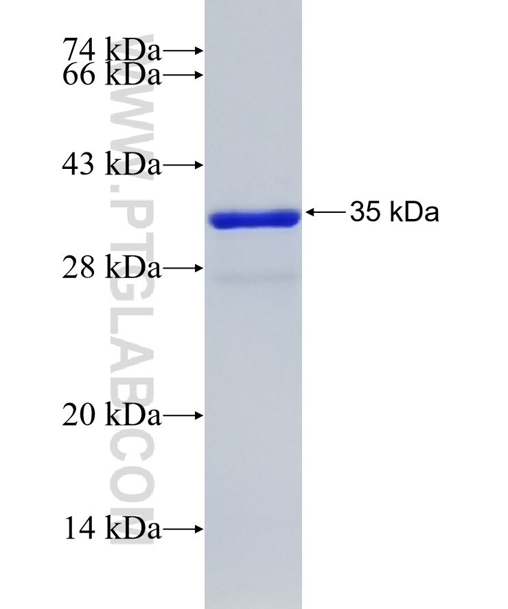 ZFX fusion protein Ag26576 SDS-PAGE