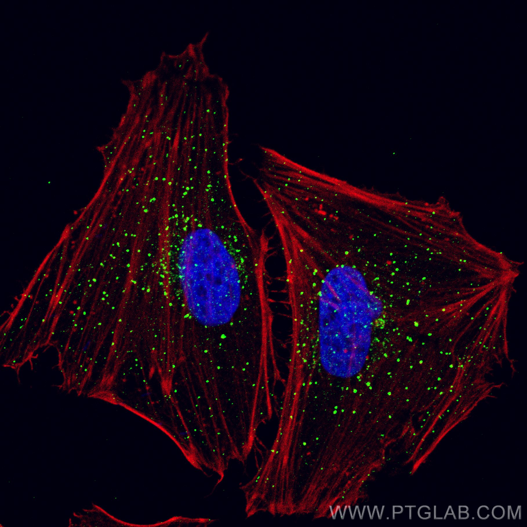 Immunofluorescence (IF) / fluorescent staining of HeLa cells using ZFYVE16 Polyclonal antibody (13118-2-AP)