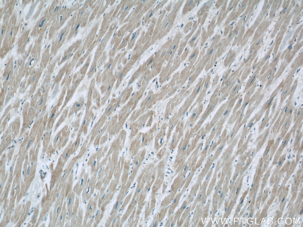 Immunohistochemistry (IHC) staining of human heart tissue using ZFYVE16 Polyclonal antibody (13118-2-AP)