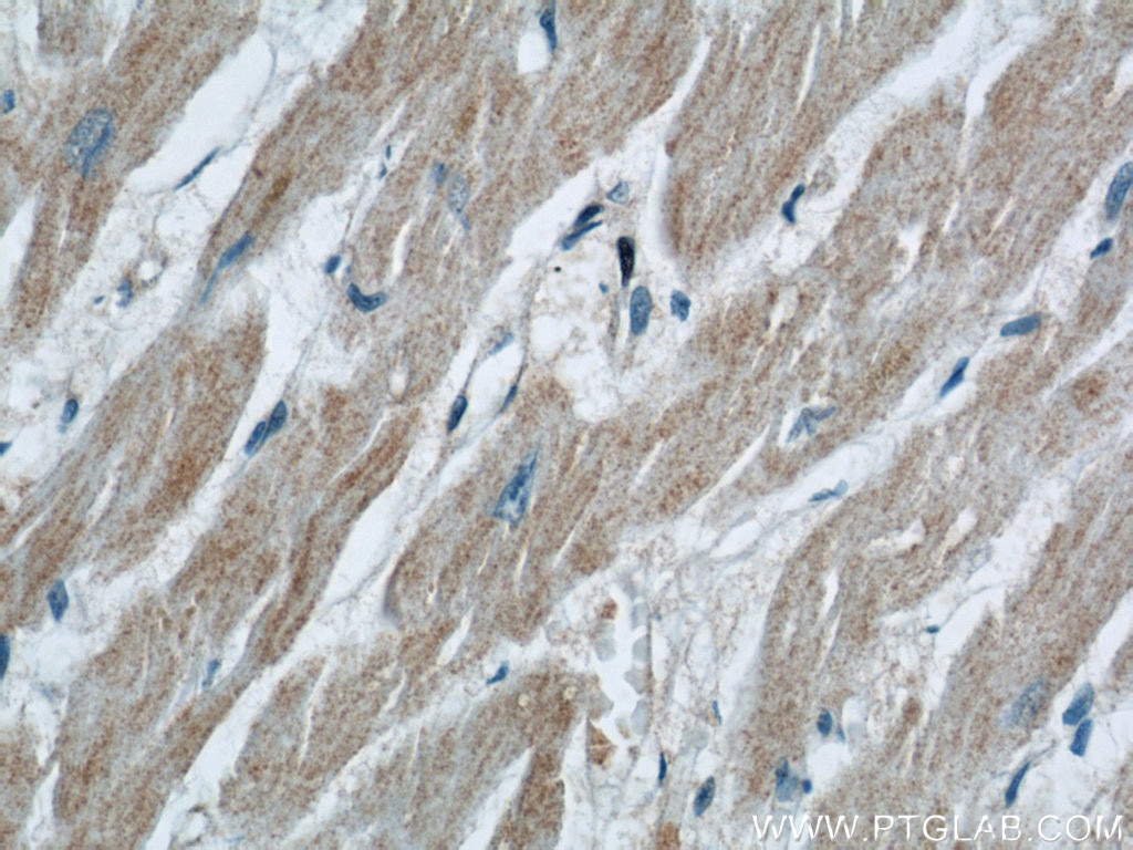 IHC staining of human heart using 13118-2-AP