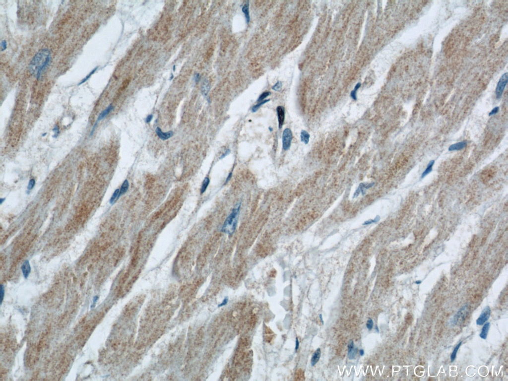 Immunohistochemistry (IHC) staining of human heart tissue using ZFYVE16 Polyclonal antibody (13118-2-AP)