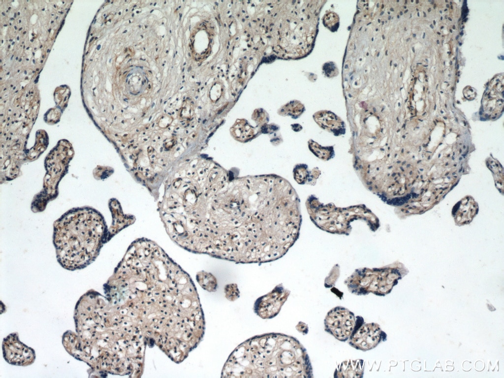 Immunohistochemistry (IHC) staining of human placenta tissue using ZFYVE16 Polyclonal antibody (13118-2-AP)