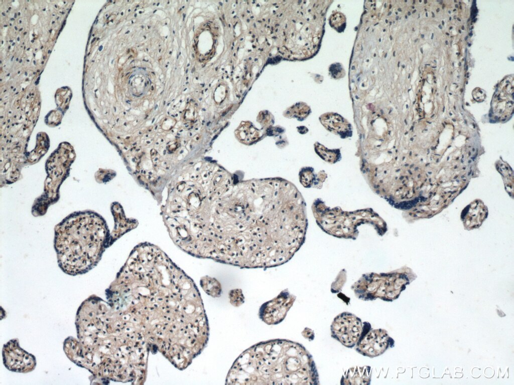 IHC staining of human placenta using 13118-2-AP