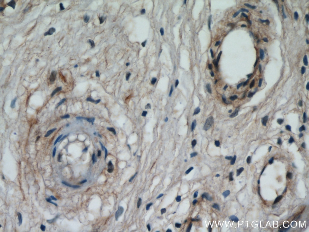 Immunohistochemistry (IHC) staining of human placenta tissue using ZFYVE16 Polyclonal antibody (13118-2-AP)