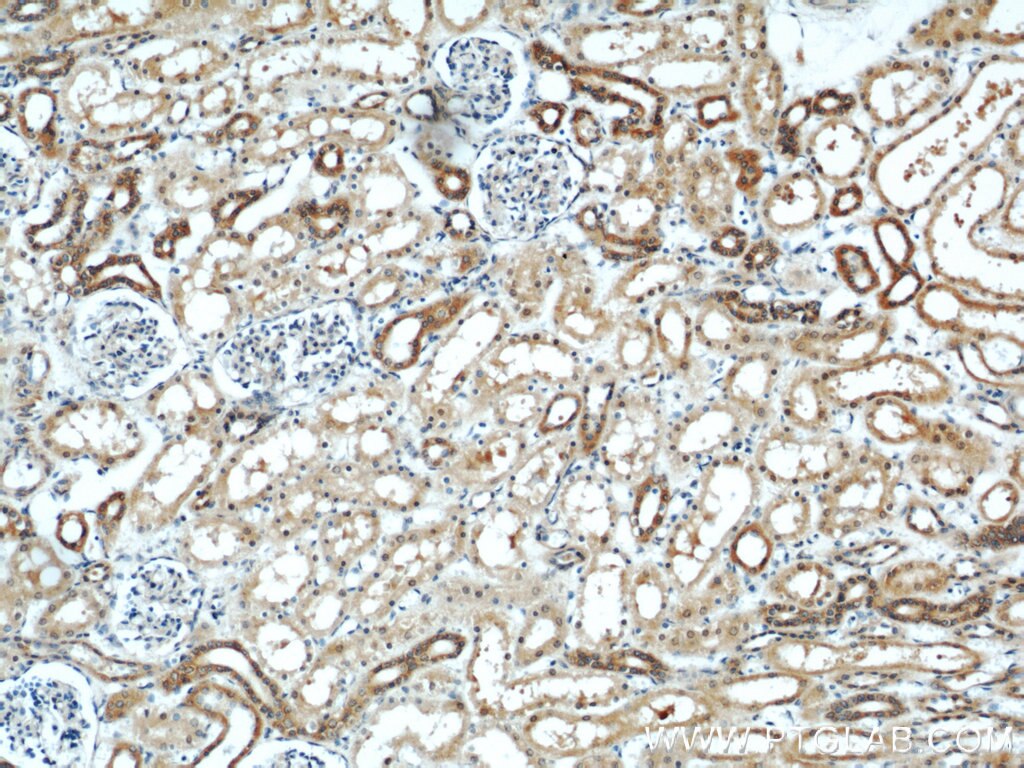 IHC staining of human kidney using 13118-2-AP