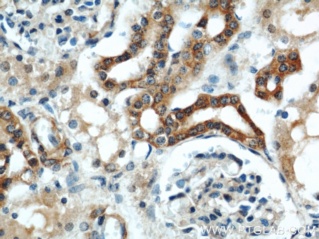 Immunohistochemistry (IHC) staining of human kidney tissue using ZFYVE16 Polyclonal antibody (13118-2-AP)