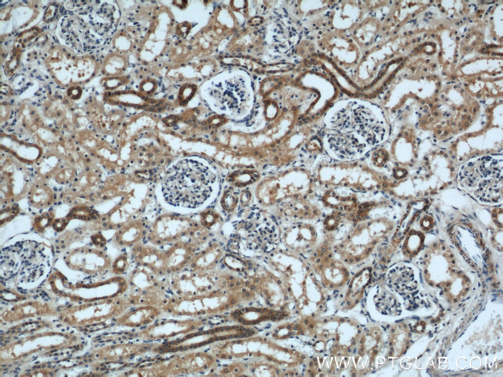 Immunohistochemistry (IHC) staining of human kidney tissue using ZFYVE16 Polyclonal antibody (13118-2-AP)