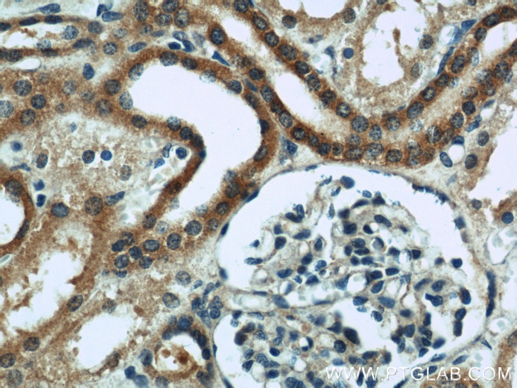 Immunohistochemistry (IHC) staining of human kidney tissue using ZFYVE16 Polyclonal antibody (13118-2-AP)