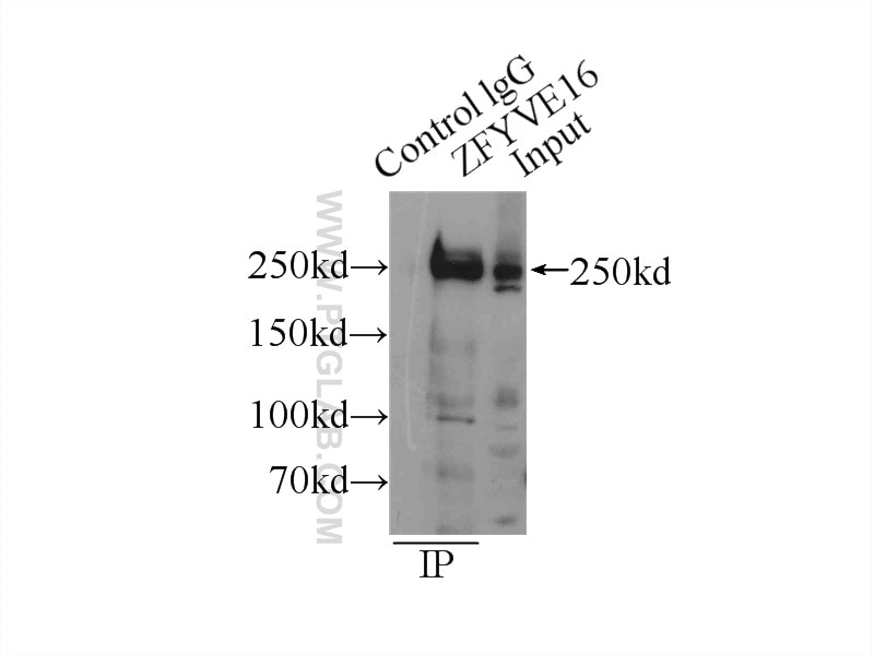 Immunoprecipitation (IP) experiment of HeLa cells using ZFYVE16 Polyclonal antibody (13118-2-AP)