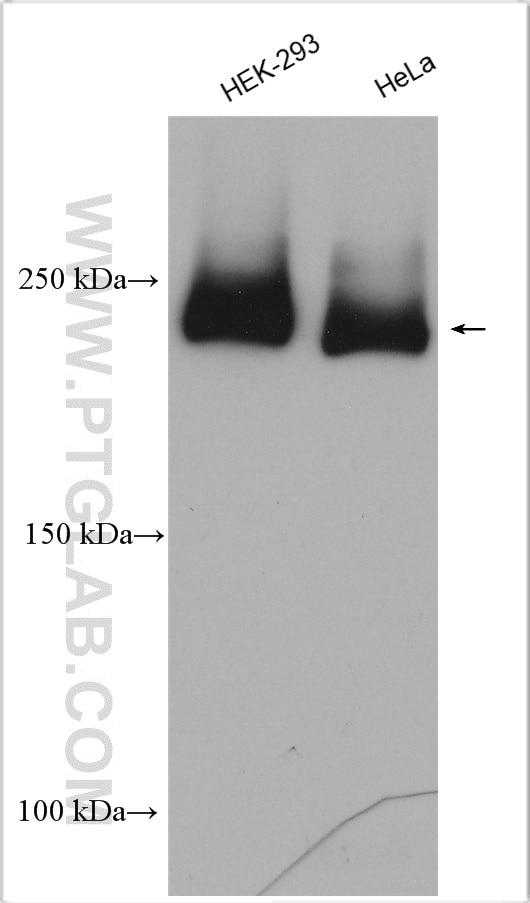 Western Blot (WB) analysis of various lysates using ZFYVE16 Polyclonal antibody (13118-2-AP)