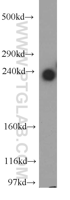 WB analysis of mouse kidney using 13118-2-AP