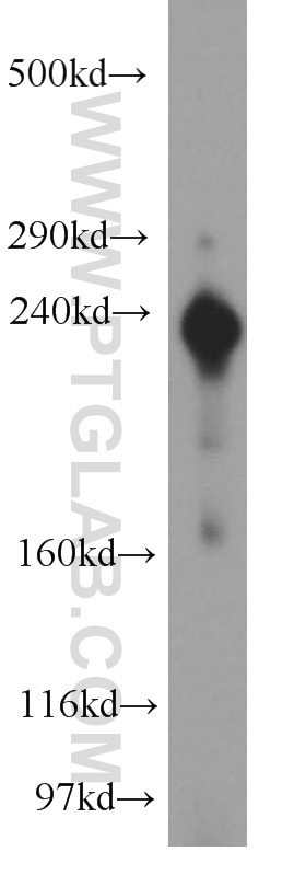 Western Blot (WB) analysis of human placenta tissue using ZFYVE16 Polyclonal antibody (13118-2-AP)