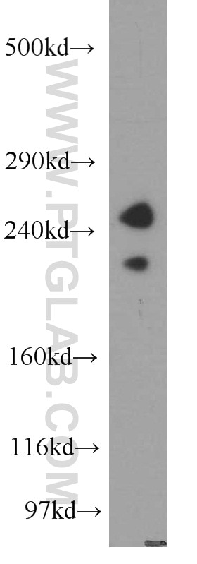 Western Blot (WB) analysis of HEK-293 cells using ZFYVE16 Polyclonal antibody (13118-2-AP)
