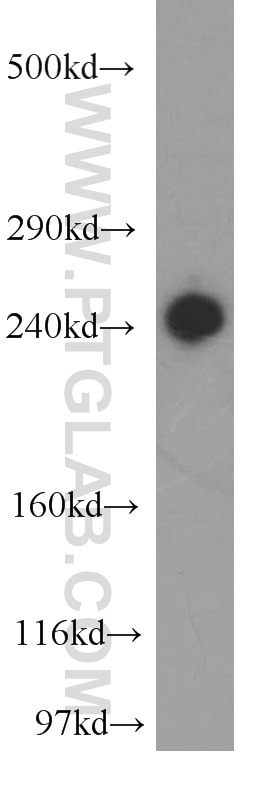 Western Blot (WB) analysis of HeLa cells using ZFYVE16 Polyclonal antibody (13118-2-AP)