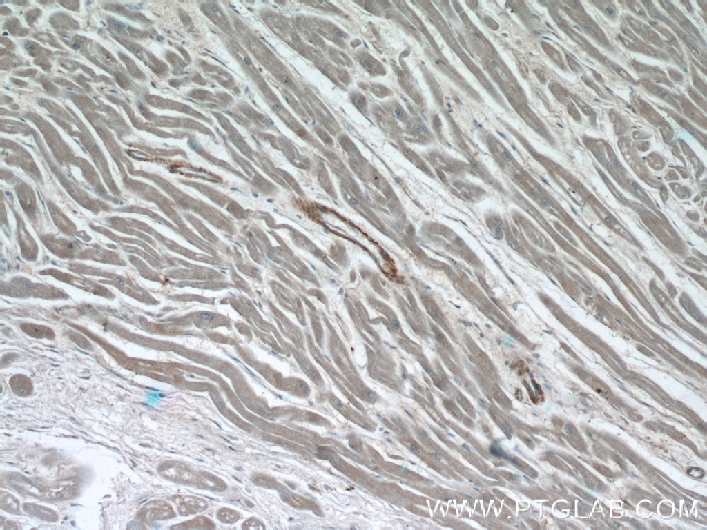 Immunohistochemistry (IHC) staining of human heart tissue using ZFYVE19 Polyclonal antibody (23163-1-AP)
