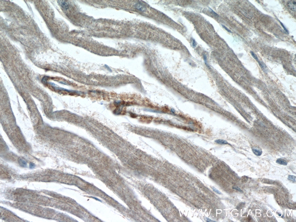 Immunohistochemistry (IHC) staining of human heart tissue using ZFYVE19 Polyclonal antibody (23163-1-AP)