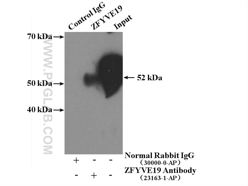 Immunoprecipitation (IP) experiment of Raji cells using ZFYVE19 Polyclonal antibody (23163-1-AP)