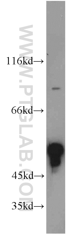Western Blot (WB) analysis of Raji cells using ZFYVE19 Polyclonal antibody (23163-1-AP)