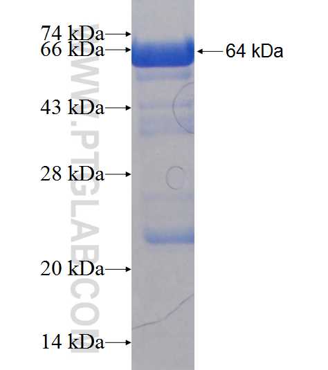 ZFYVE19 fusion protein Ag19593 SDS-PAGE