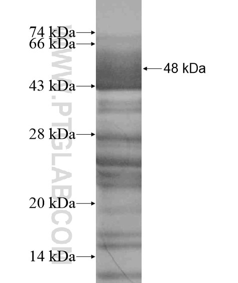 ZFYVE19 fusion protein Ag19627 SDS-PAGE