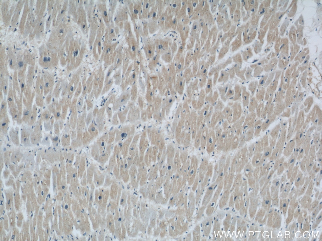 Immunohistochemistry (IHC) staining of human heart tissue using Rabenosyn 5 Polyclonal antibody (22218-1-AP)