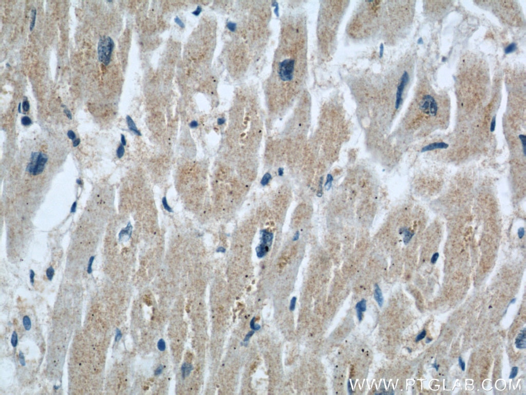 Immunohistochemistry (IHC) staining of human heart tissue using Rabenosyn 5 Polyclonal antibody (22218-1-AP)