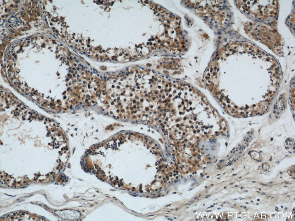 Immunohistochemistry (IHC) staining of human testis tissue using Rabenosyn 5 Polyclonal antibody (22218-1-AP)