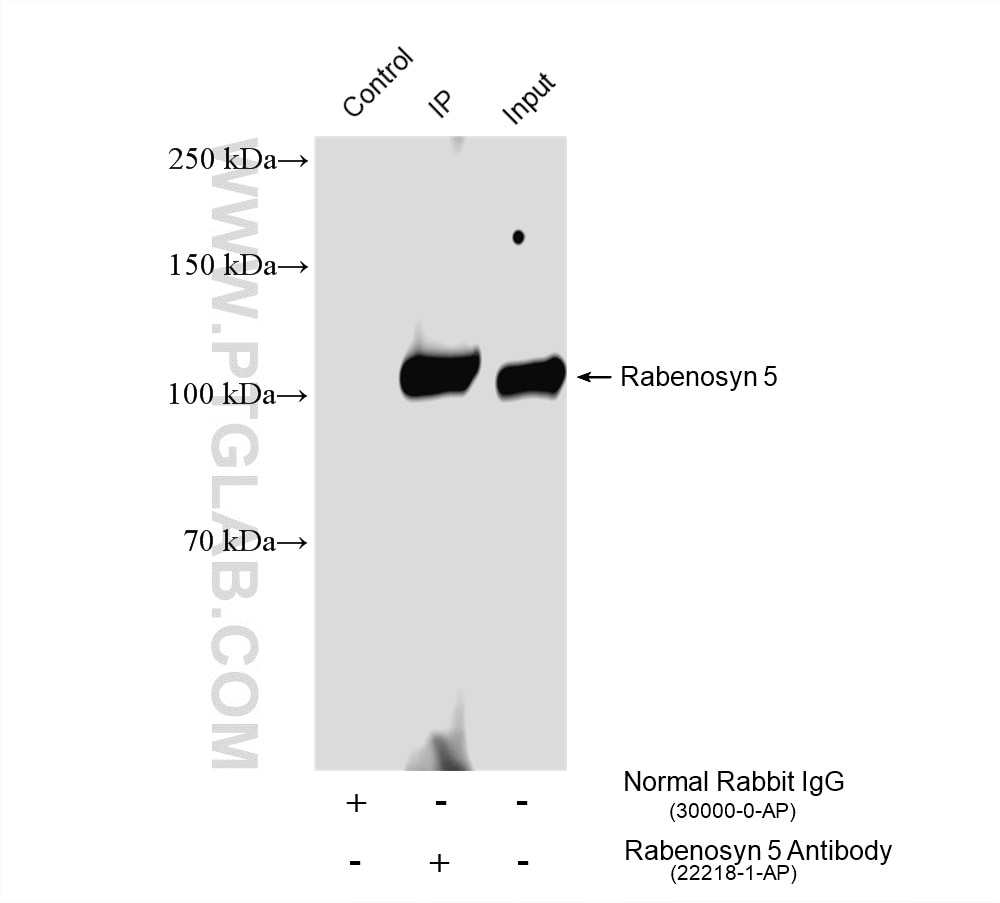 Immunoprecipitation (IP) experiment of mouse heart tissue using Rabenosyn 5 Polyclonal antibody (22218-1-AP)