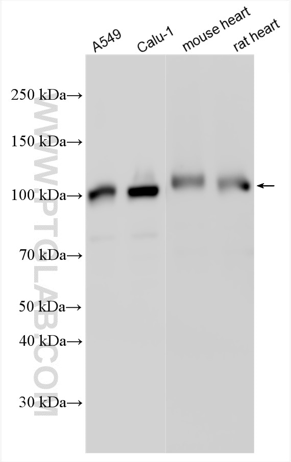 Western Blot (WB) analysis of various lysates using Rabenosyn 5 Polyclonal antibody (22218-1-AP)