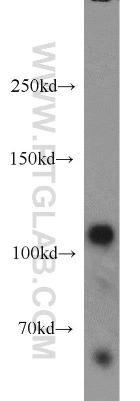 Western Blot (WB) analysis of mouse brain tissue using Rabenosyn 5 Polyclonal antibody (22218-1-AP)