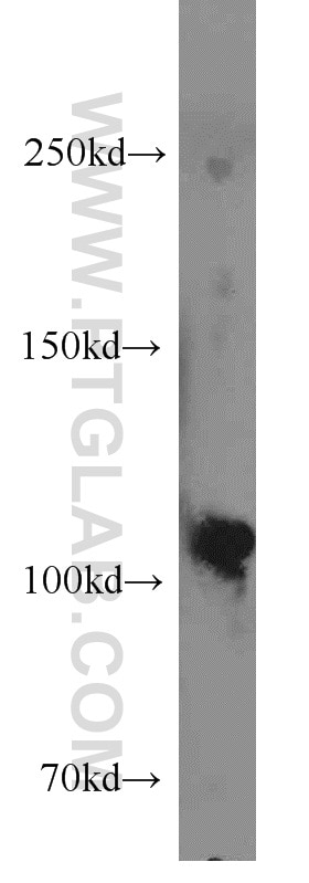 Western Blot (WB) analysis of mouse skeletal muscle tissue using Rabenosyn 5 Polyclonal antibody (22218-1-AP)