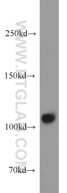 Western Blot (WB) analysis of mouse kidney tissue using Rabenosyn 5 Polyclonal antibody (22218-1-AP)