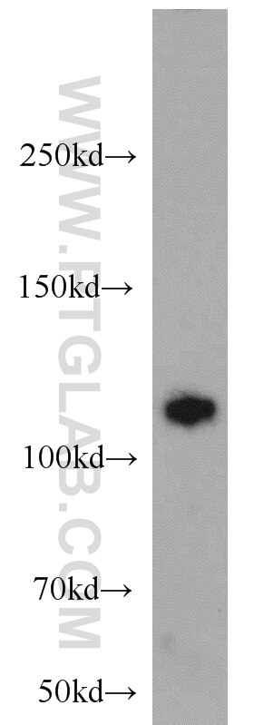 Western Blot (WB) analysis of K-562 cells using Rabenosyn 5 Polyclonal antibody (22218-1-AP)