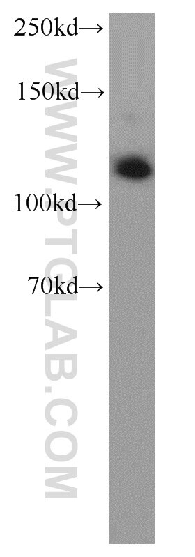 Western Blot (WB) analysis of mouse testis tissue using Rabenosyn 5 Polyclonal antibody (22218-1-AP)