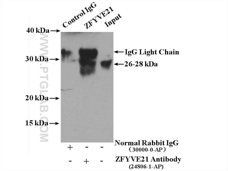 Immunoprecipitation (IP) experiment of HT-1080 cells using ZFYVE21 Polyclonal antibody (24806-1-AP)