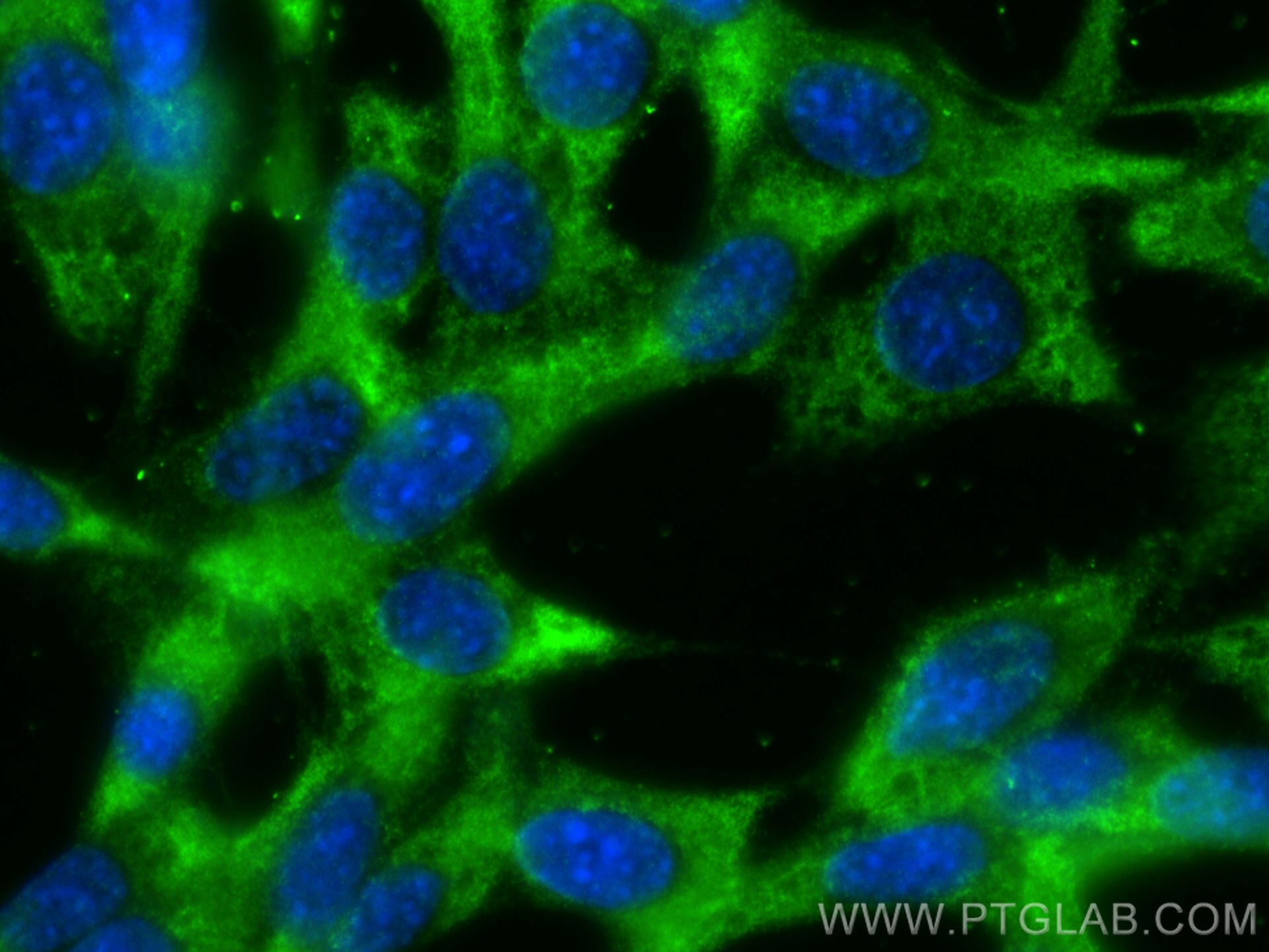 Immunofluorescence (IF) / fluorescent staining of NIH/3T3 cells using ZFYVE26 Polyclonal antibody (55418-1-AP)