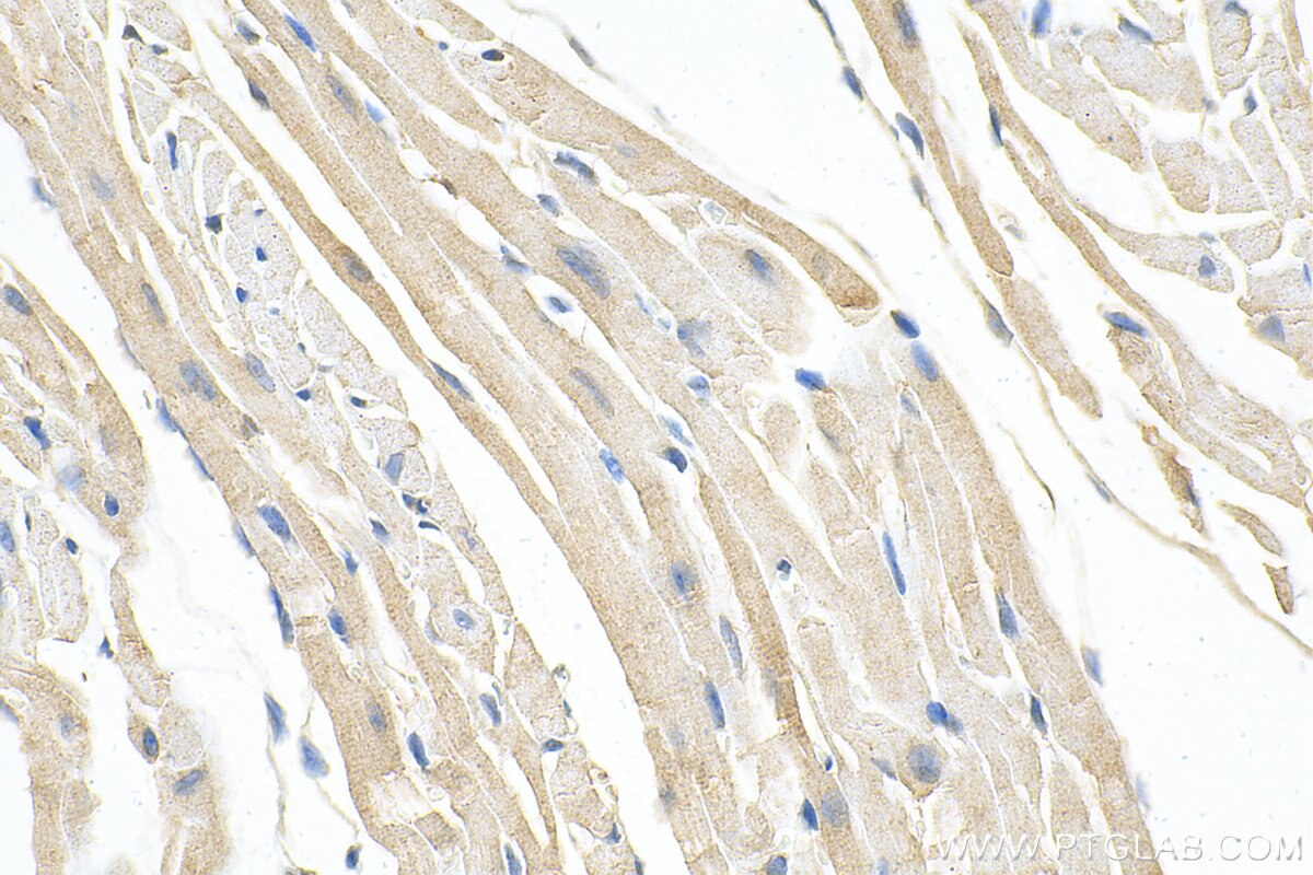 Immunohistochemistry (IHC) staining of mouse heart tissue using ZFYVE26 Polyclonal antibody (55418-1-AP)