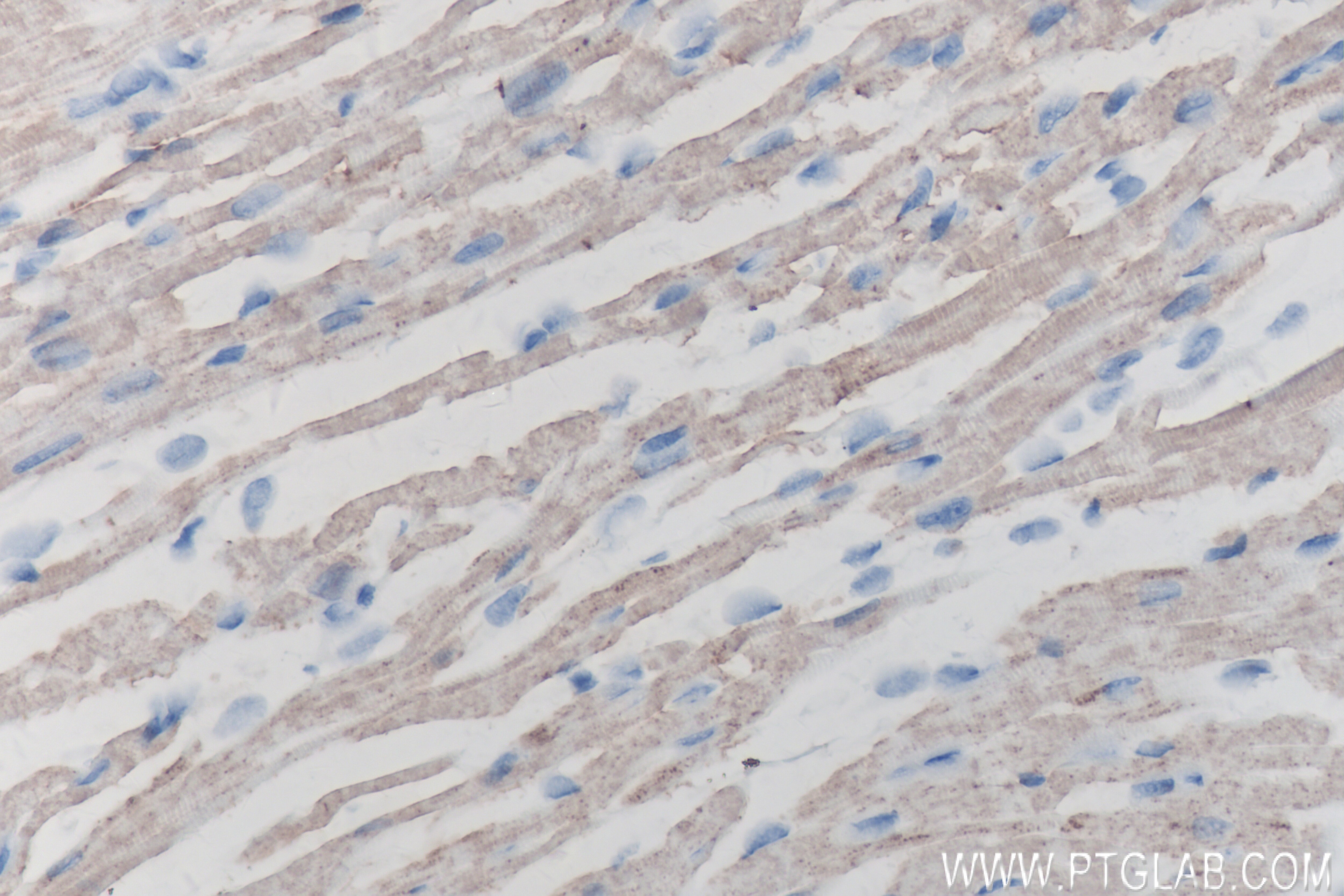 Immunohistochemistry (IHC) staining of mouse heart tissue using ZFYVE26 Recombinant antibody (83215-4-RR)