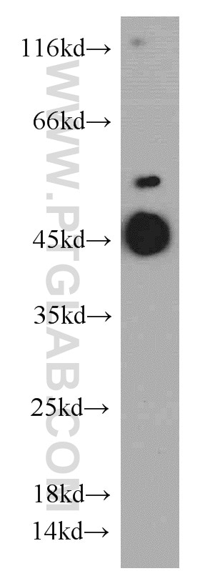 Western Blot (WB) analysis of mouse brain tissue using Protrudin Polyclonal antibody (12680-1-AP)