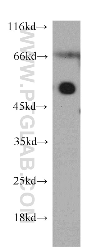 Western Blot (WB) analysis of Jurkat cells using Protrudin Polyclonal antibody (12680-1-AP)