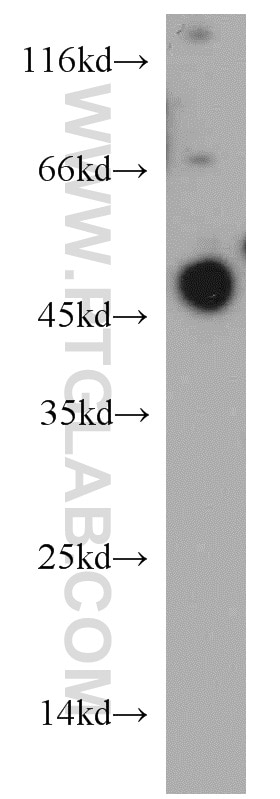 Western Blot (WB) analysis of mouse testis tissue using Protrudin Polyclonal antibody (12680-1-AP)